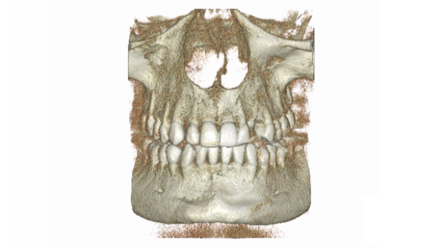 Pozabiegowe: szczęka, żuchwa