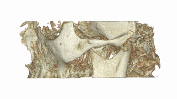 SSŻ zwarte lub rozwate