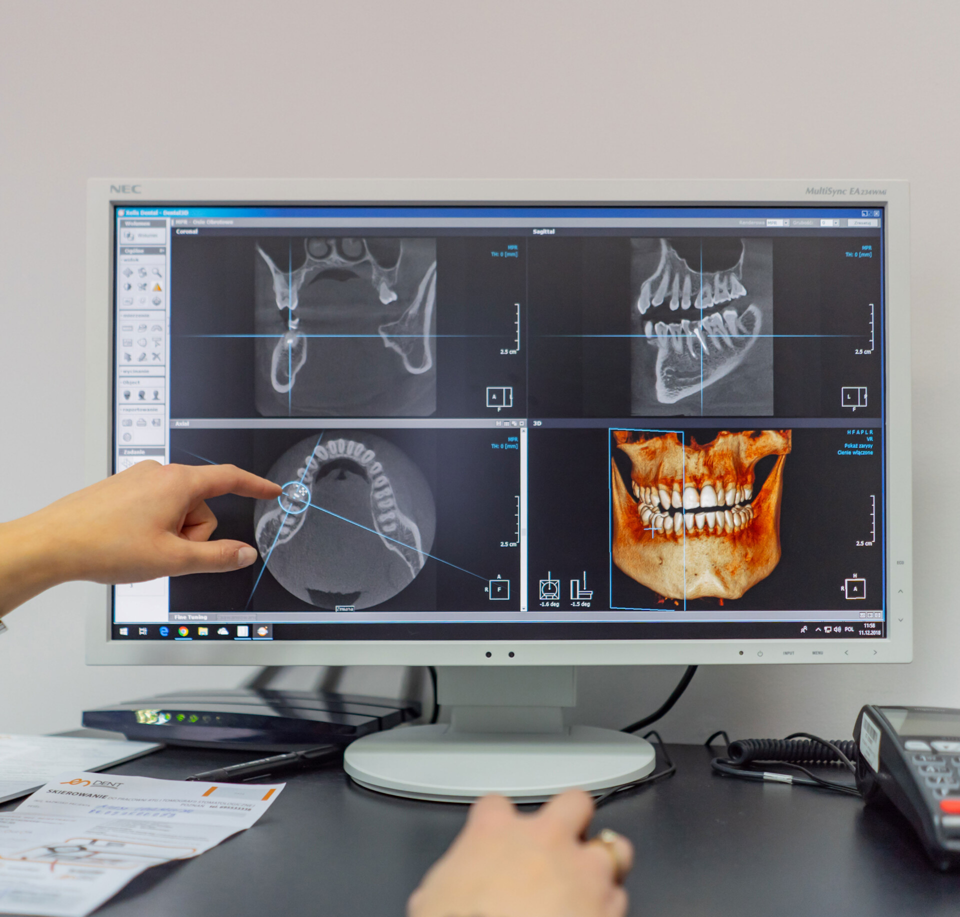 OnDemand oprogramowanie