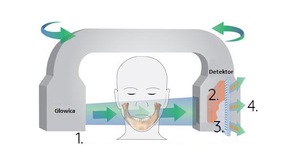 infografika tomograf wiazki stazkowej cbct 1744197801