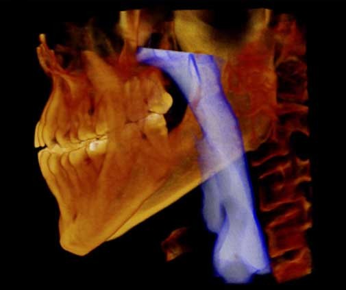 Tomografia dróg oddechowych Lubin