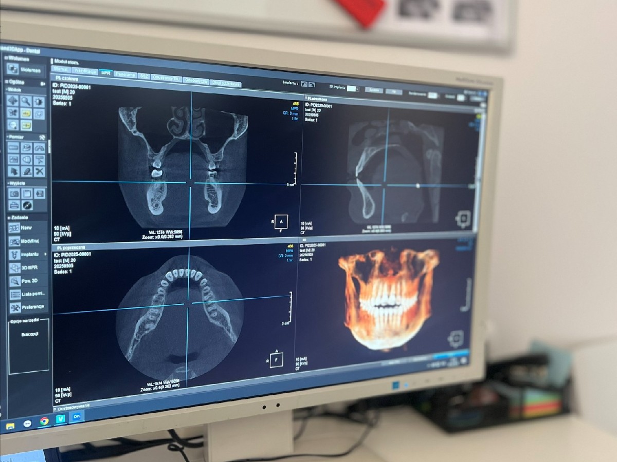Cefalometria w ESDENT