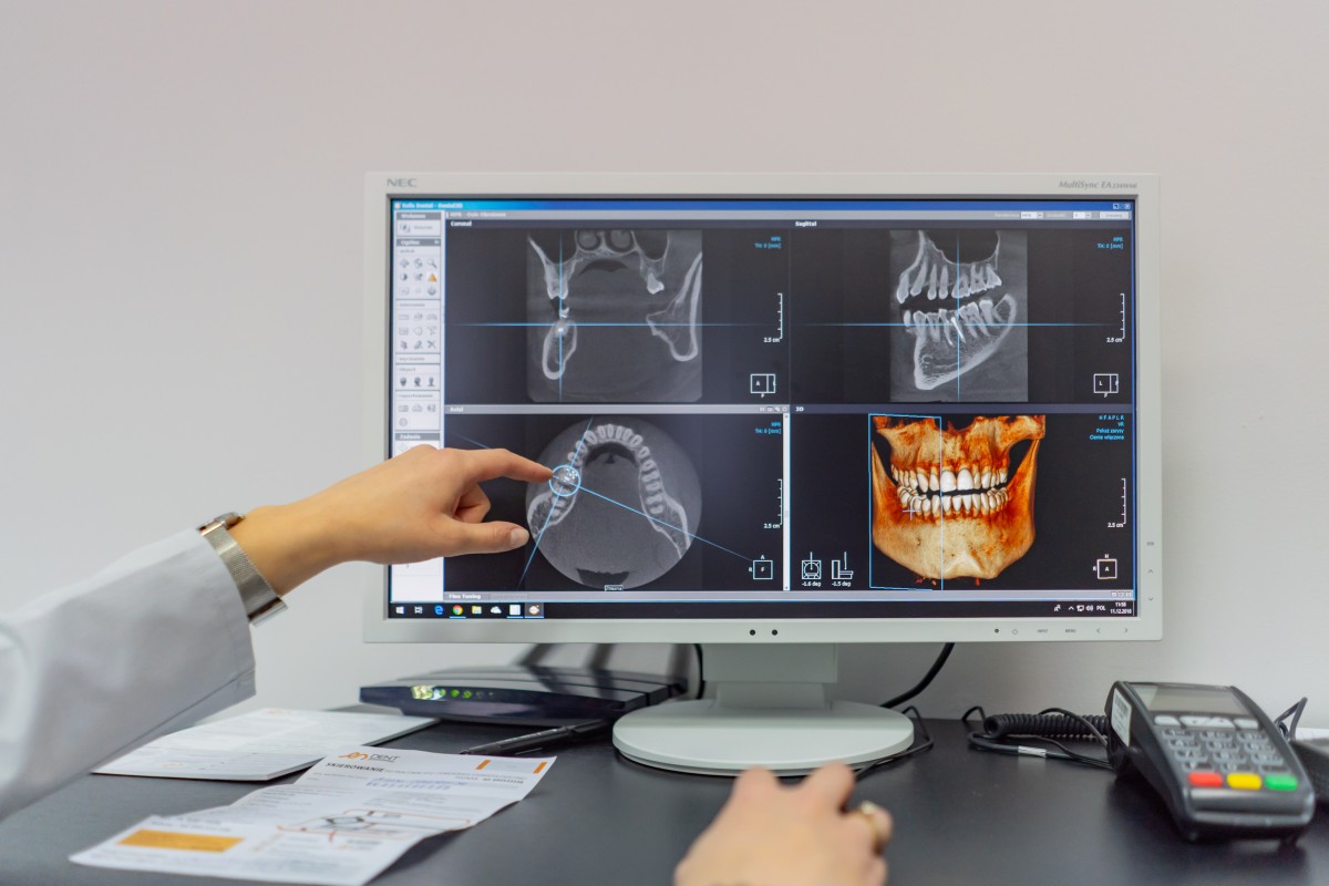 Tomografia twarzoczaszki Lubin - stanowisko biurowe