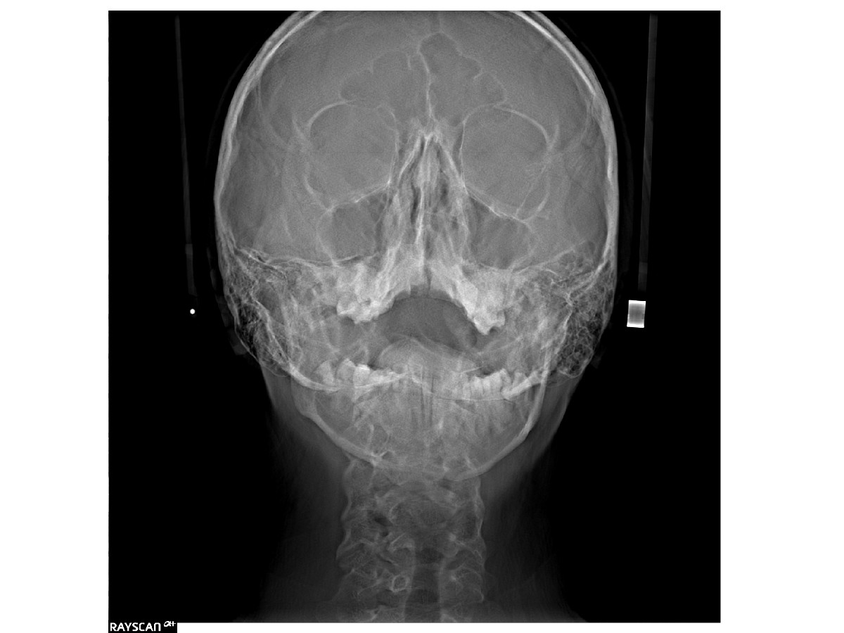 Zdjęcie zatok ESDENT Wrocław